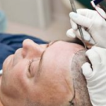 The Cost of Hair Transplants: Is It Worth It?