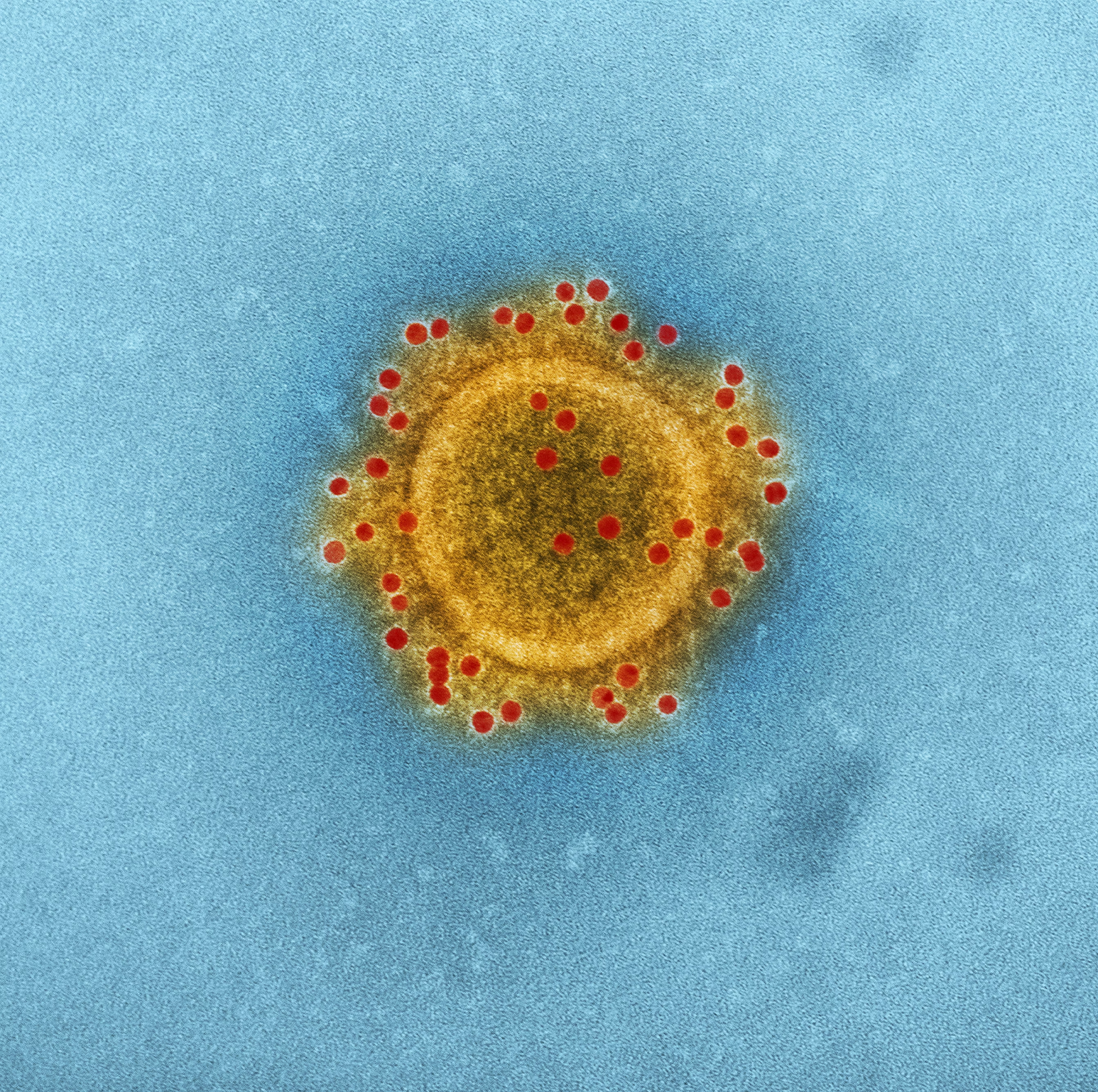 An Essential Guide To Chronic Myeloid Leukemia