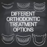 Understanding the Different Orthodontic Treatment Options in San Francisco