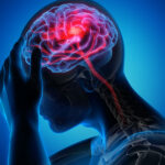 Understanding Traumatic Brain Injuries: Causes, Symptoms, And Treatment Options