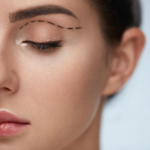 Four  Benefits of Eyelid Surgery