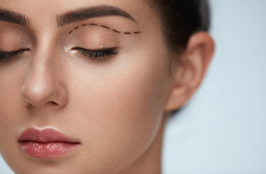 Four  Benefits of Eyelid Surgery