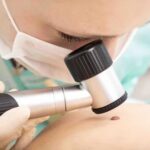 Top Clinics for Mole and Skin Tag Removal in Portland, Oregon