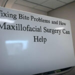 Fixing Bite Problems and How Maxillofacial Surgery Can Help