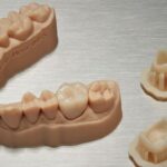 3D Printing in Dentistry: The Next Big Thing for Your Smile