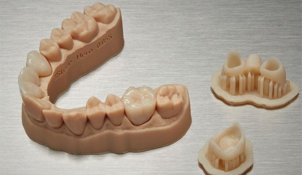 3D Printing in Dentistry: The Next Big Thing for Your Smile