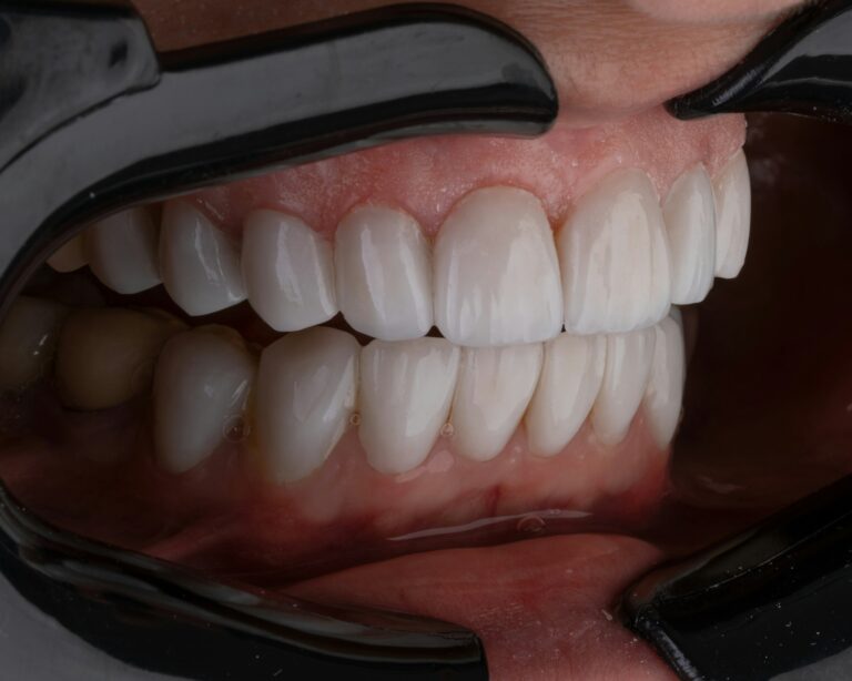 Signs You May Require Specialist Attention for Your Gum Health