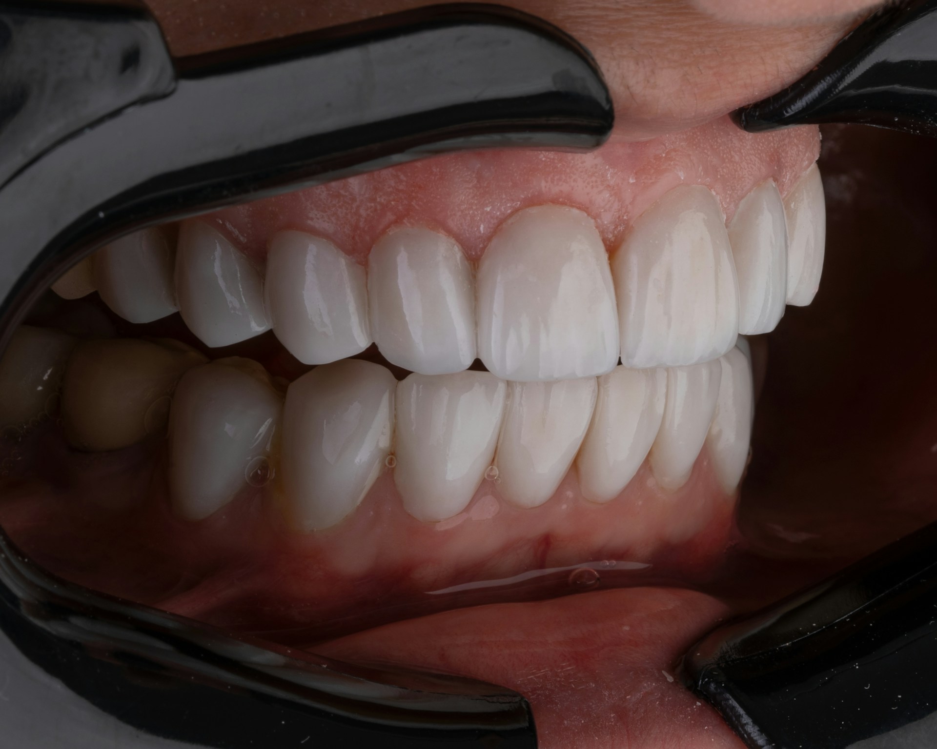 Signs You May Require Specialist Attention for Your Gum Health
