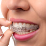 Speed Meets Precision: Invisalign Treatment Options Near You