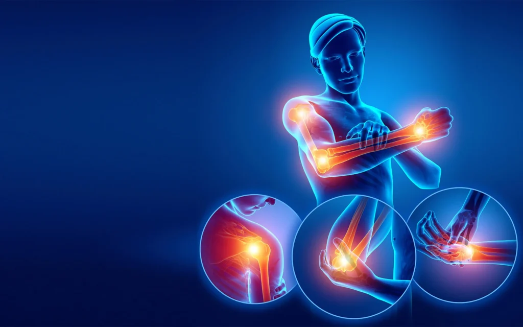 Long-Term Pain Management