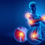 Long-Term Pain Management