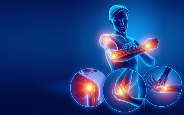 Long-Term Pain Management