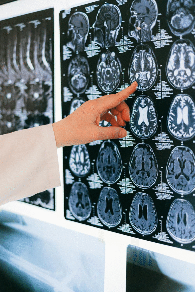 Essential Recovery Tips Following a Brain Injury