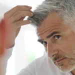 Hair Implant in Switzerland: A Trusted Destination for Advanced Hair Restoration