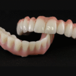 Why Dental Implants In Sydney Are The Best Solution For Missing Teeth?