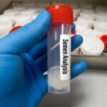 Semen analysis test
