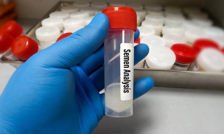 Semen analysis test