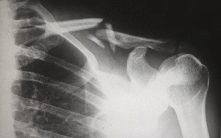 Reasons Why You're Experiencing Shoulder Pain