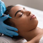 Dermal Fillers
