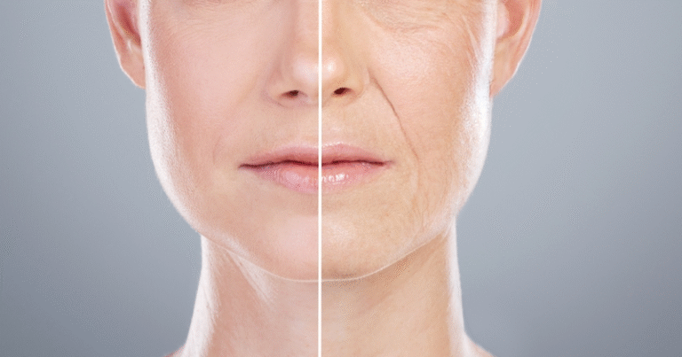 Anti-Aging Treatments