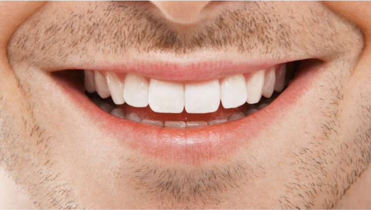 Dental Implants: A Permanent Solution for Missing Teeth