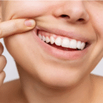 How to Achieve a Natural-Looking Smile with Cosmetic Dentistry