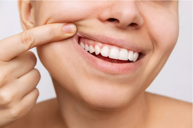 How to Achieve a Natural-Looking Smile with Cosmetic Dentistry