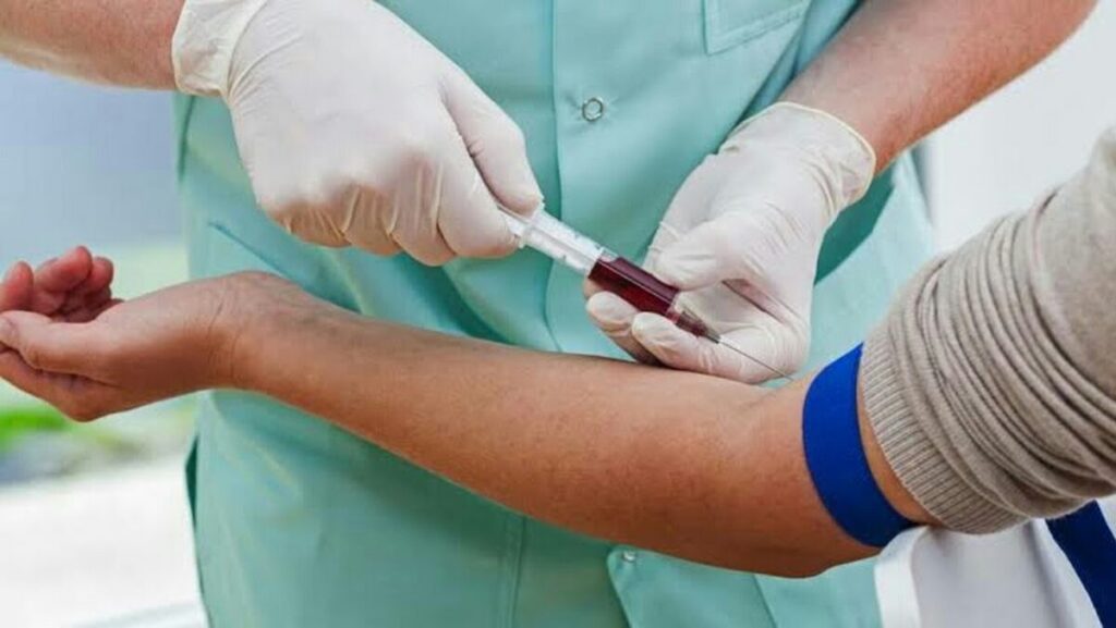 Why Regular Lab at Home Testing Appointments Are Crucial