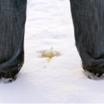 Modern BPH Treatment: Why Surgery Isn’t What It Used to Be