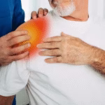 Shoulder Dislocation