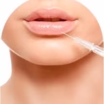 Buy Dermal Fillers Online USA