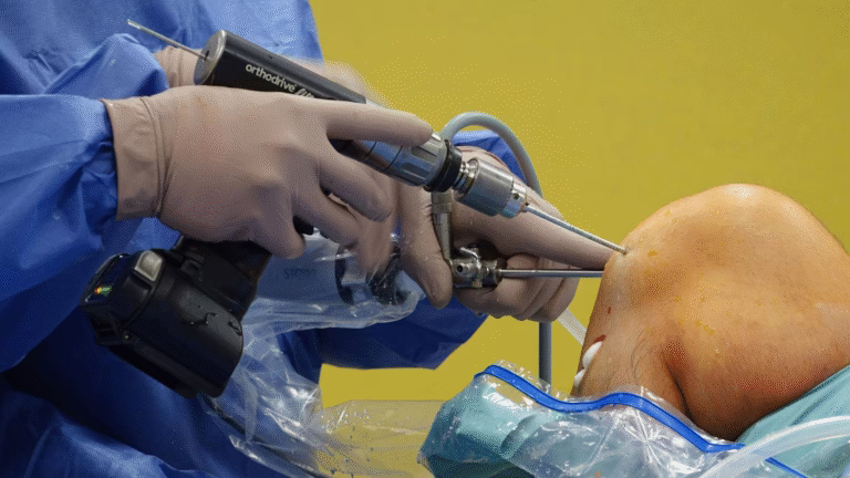 Knee Replacement Surgery