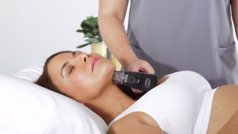 Is Morpheus8 Worth It? NYC Skin Experts Break Down the Results