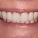 Worst Dental Emergency? Tech-Driven Workflows for Rapid, Comforting Smile Restoration