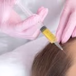 The Science Behind PRP Treatment in Chennai: Why It’s Effective For Both Hair Restoration and Skin Rejuvenation