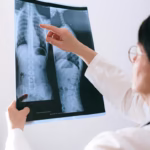 What Is 360 Back Surgery a Guide for New Jersey Patients
