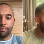 Afro Hair Transplant Recovery