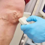 Vein Specialists