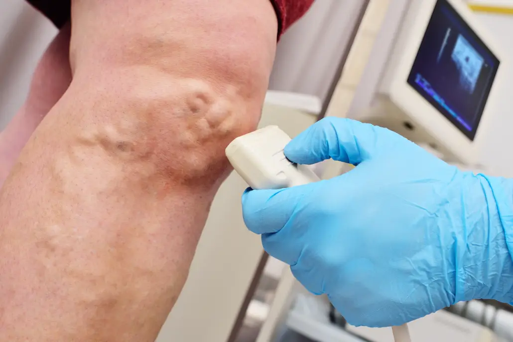 Vein Specialists