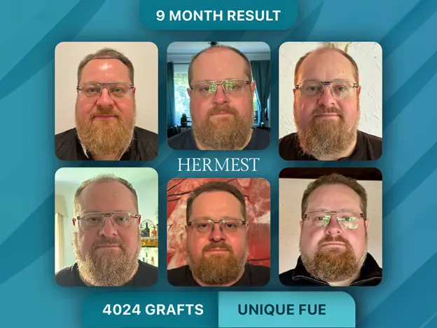 Why Hermest Is the Only Istanbul Clinic Where Four International Quality Certifications Converge