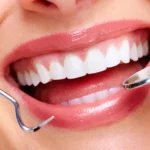 Dental Treatment