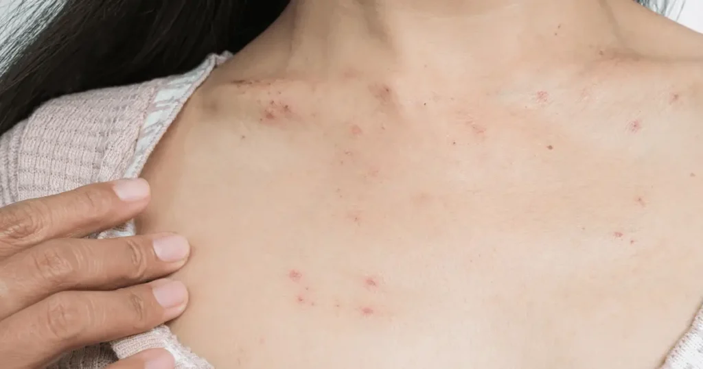 High-Risk Skin Warning Signs