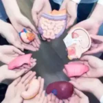 Organ Transplant