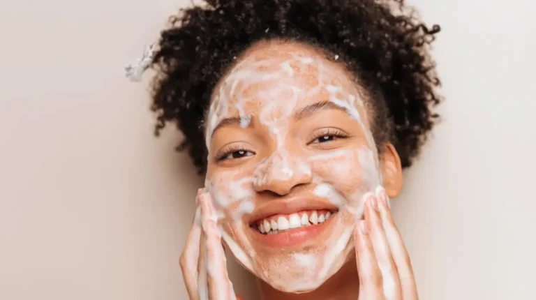Pimples Around Mouth