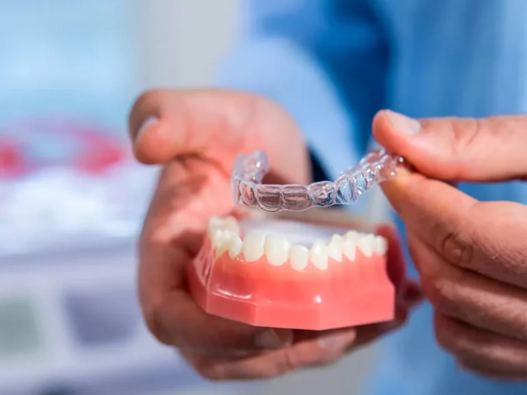 5 Reasons Clear Aligners Are Changing Orthodontics