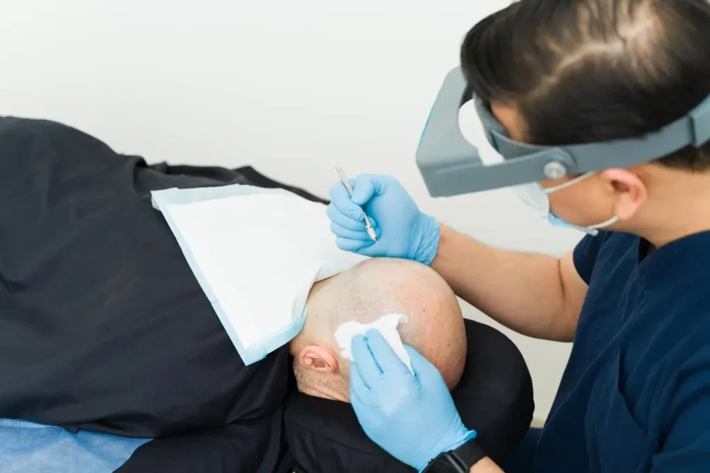 What Are Benefits Of Hair Replacement Clinic Treatments For Men