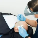 What Are Benefits Of Hair Replacement Clinic Treatments For Men
