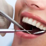 How General Dentistry Detects Issues Before Pain Or Symptoms Appear