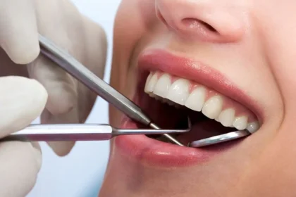 How General Dentistry Detects Issues Before Pain Or Symptoms Appear