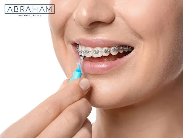 6 Tips For Maintaining Healthy Teeth During Orthodontic Treatment